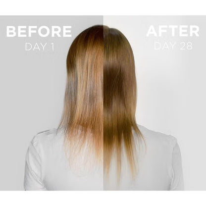 Grow Gorgeous Density Serum Intense - Hair Growth Serum With Caffeine. For Thin and Damaged Hair. Increases Thickness Of Each Strand By Up To 13%. 2 Fl Oz